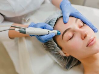 Microneedling Toulouse