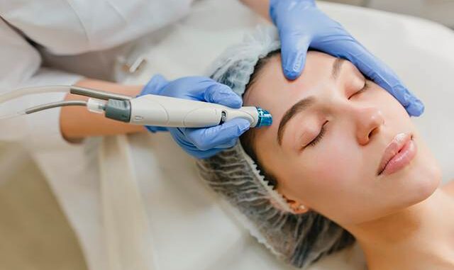 Microneedling Toulouse