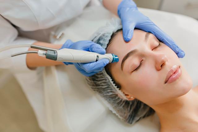 microneedling-toulouse